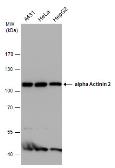 Anti-alpha Actinin 2 antibody [GT1253] used in Western Blot (WB). GTX632361