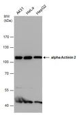 Anti-alpha Actinin 2 antibody [GT1253] used in Western Blot (WB). GTX632361