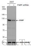Anti-PARP antibody [GT982] used in Western Blot (WB). GTX632388