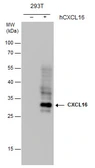 Anti-CXCL16 antibody [GT5212] used in Western Blot (WB). GTX632390