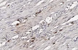 Anti-CXCL16 antibody [GT5212] used in IHC (Paraffin sections) (IHC-P). GTX632390