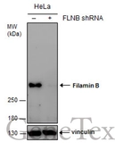 Anti-Filamin B antibody [GT387] used in Western Blot (WB). GTX632425