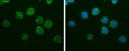 Anti-Iba1 antibody [GT10312] used in Immunocytochemistry/ Immunofluorescence (ICC/IF). GTX632426