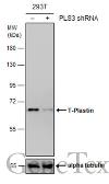Anti-T-Plastin antibody [GT236] used in Western Blot (WB). GTX632481