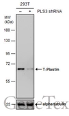 Anti-T-Plastin antibody [GT236] used in Western Blot (WB). GTX632481