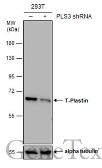 Anti-T-Plastin antibody [GT3310] used in Western Blot (WB). GTX632482