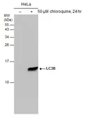Anti-LC3B antibody [GT3612] used in Western Blot (WB). GTX632501