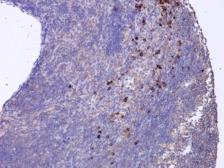Anti-CXCL16 antibody [GT516] used in IHC (Paraffin sections) (IHC-P). GTX632502