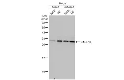 Anti-CXCL16 antibody [GT516] used in Western Blot (WB). GTX632502
