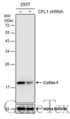 Anti-Cofilin 1 antibody [GT217] used in Western Blot (WB). GTX632582