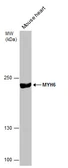Anti-MYH6 antibody [GT5612] used in Western Blot (WB). GTX632649