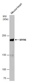 Anti-MYH6 antibody [GT565] used in Western Blot (WB). GTX632650