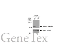 Anti-beta Catenin antibody [GT3171] used in Western Blot (WB). GTX632676