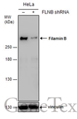 Anti-Filamin B antibody [GT1282] used in Western Blot (WB). GTX632677