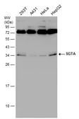Anti-SGTA antibody [6A4] used in Western Blot (WB). GTX632697