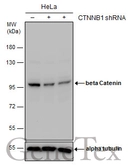 Anti-beta Catenin antibody [GT2169] used in Western Blot (WB). GTX633010
