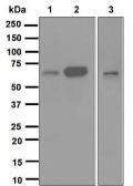 Anti-CDC25B antibody [EPR3459(2)] used in Western Blot (WB). GTX63329