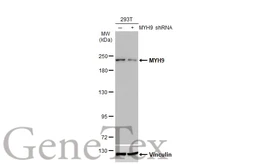 Anti-MYH9 antibody [GT218] used in Western Blot (WB). GTX633295