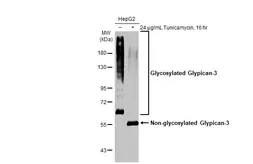 Anti-Glypican-3 antibody [GT764] used in Western Blot (WB). GTX633303