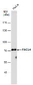 Anti-FACL4 antibody [GT186] used in Western Blot (WB). GTX633365