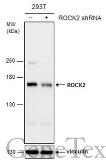 Anti-ROCK2 antibody [GT11712] used in Western Blot (WB). GTX633389