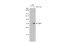 Anti-Enterovirus 71 VP1 antibody [GT185] used in Western Blot (WB). GTX633390