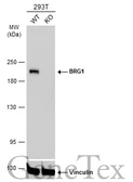 Anti-BRG1 antibody [GT2712] used in Western Blot (WB). GTX633391