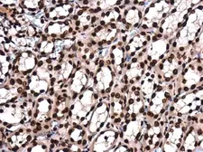 Anti-Histone H4K8ac (acetyl Lys8) antibody [GT478] used in IHC (Paraffin sections) (IHC-P). GTX633420