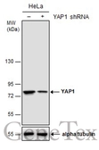 Anti-YAP1 antibody [GT256] used in Western Blot (WB). GTX633541