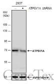 Anti-ATP6V1A antibody [GT3846] used in Western Blot (WB). GTX633542