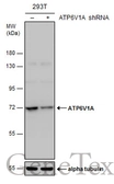 Anti-ATP6V1A antibody [GT811] used in Western Blot (WB). GTX633543