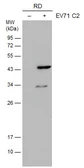 Anti-Enterovirus 71 VP1 antibody [GT9512] used in Western Blot (WB). GTX633583