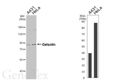 Anti-Gelsolin antibody [GT667] used in Western Blot (WB). GTX633675