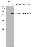 Anti-Heme Oxygenase 1 antibody [GT1334] used in Western Blot (WB). GTX633676