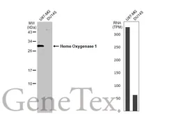 Anti-Heme Oxygenase 1 antibody [GT17811] used in Western Blot (WB). GTX633677