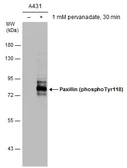 Anti-Paxillin (phospho Tyr118) antibody [GT162] used in Western Blot (WB). GTX633678