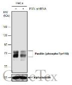 Anti-Paxillin (phospho Tyr118) antibody [GT162] used in Western Blot (WB). GTX633678
