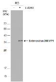 Anti-Enterovirus D68 VP1 antibody [GT162] used in Western Blot (WB). GTX633687