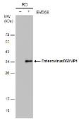 Anti-Enterovirus D68 VP1 antibody [GT11610] used in Western Blot (WB). GTX633688