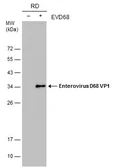 Anti-Enterovirus D68 VP1 antibody [GT11610] used in Western Blot (WB). GTX633688