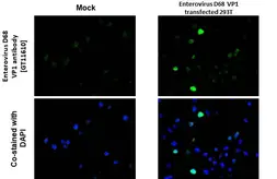 Anti-Enterovirus D68 VP1 antibody [GT11610] used in IHC-P (cell pellet) (IHC-P (cell pellet)). GTX633688