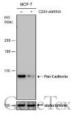 Anti-pan Cadherin antibody [GT2610] used in Western Blot (WB). GTX633689