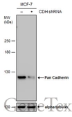 Anti-pan Cadherin antibody [GT2610] used in Western Blot (WB). GTX633689