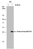 Anti-Enterovirus D68 VP3 antibody [GT1665] used in Western Blot (WB). GTX633706