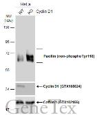 Anti-Paxillin (non-phospho Tyr118) antibody [GT722] used in Western Blot (WB). GTX633707
