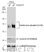 Anti-Paxillin (non-phospho Tyr118) antibody [GT722] used in Western Blot (WB). GTX633707