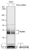 Anti-Paxillin antibody [GT7612] used in Western Blot (WB). GTX633769