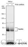 Anti-Paxillin antibody [GT7612] used in Western Blot (WB). GTX633769