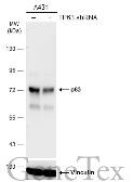 Anti-p63 antibody [GT1179] used in Western Blot (WB). GTX633818