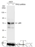 Anti-p63 antibody [GT1179] used in Western Blot (WB). GTX633818